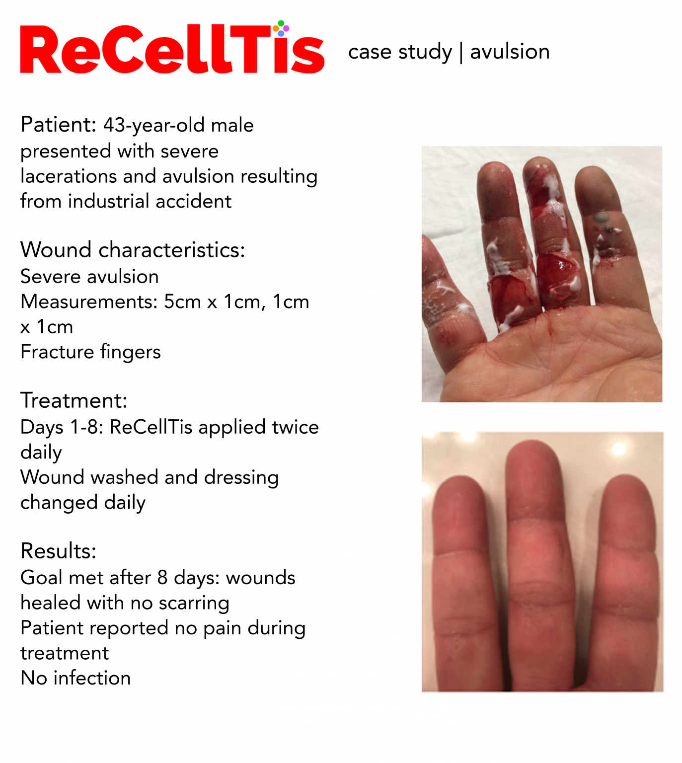 recelltis case study